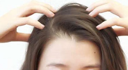 不做禿頭，掉發(fā)嚴重趕緊解決