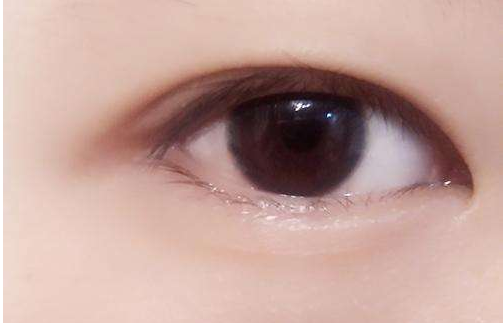 雙眼皮無能為力的時候，竟是遭遇了這些問題？
