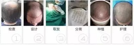 好看的皮囊千千萬，但都有一個共同點-頭發(fā)！