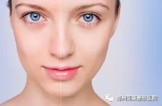 25歲以后，這些醫(yī)美項(xiàng)目可比你們的所有護(hù)膚品都強(qiáng)！