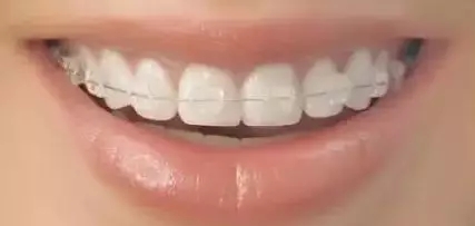 問診室：關于正畸，不止你想的這么簡單喔