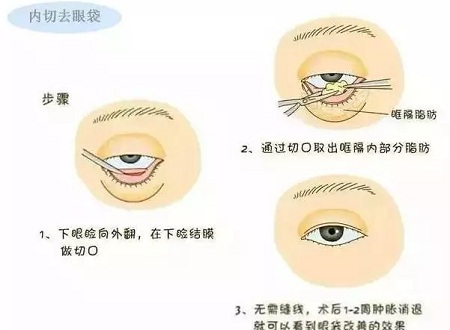 還把眼袋當(dāng)臥蠶？那就別怪小弟弟喊你阿姨了