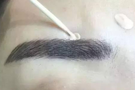 眉毛種植手術(shù)過程是怎樣的，多久能看到效果
