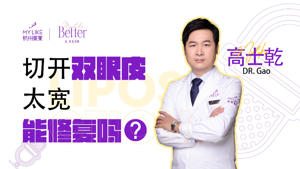 杭州美萊：切開雙眼皮太寬能修復嗎？