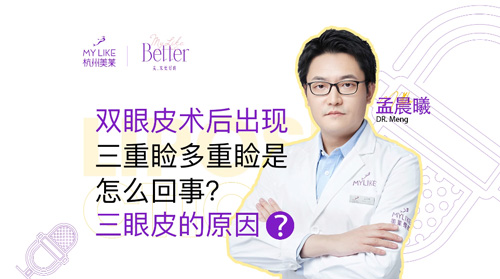 杭州美萊：雙眼皮術后出現(xiàn)三重瞼多重瞼是怎么回事？