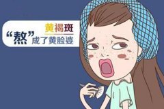 激光真的能去黃褐斑嗎，祛斑價格是多少