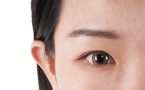 西安激光去魚尾紋醫(yī)院哪家好一點(diǎn)，效果可以保持多久